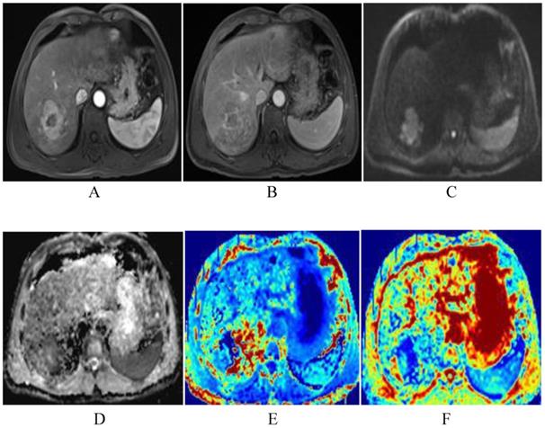 J Cancer Image