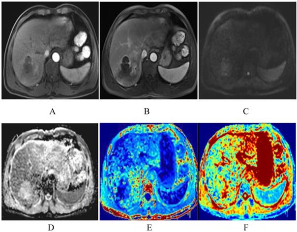 J Cancer Image