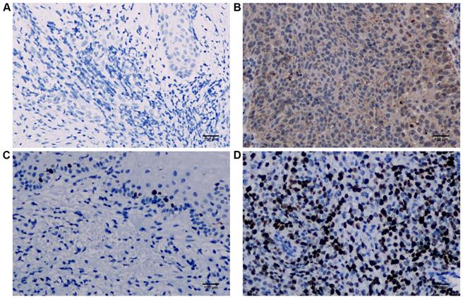 J Cancer Image