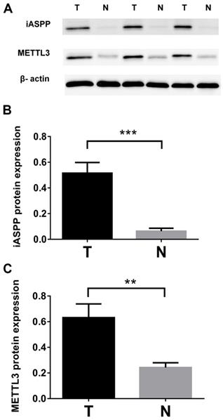 J Cancer Image