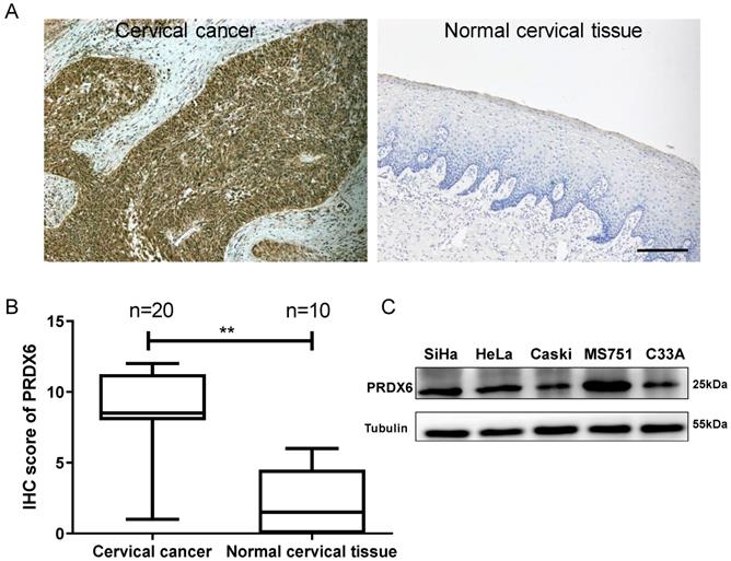 J Cancer Image