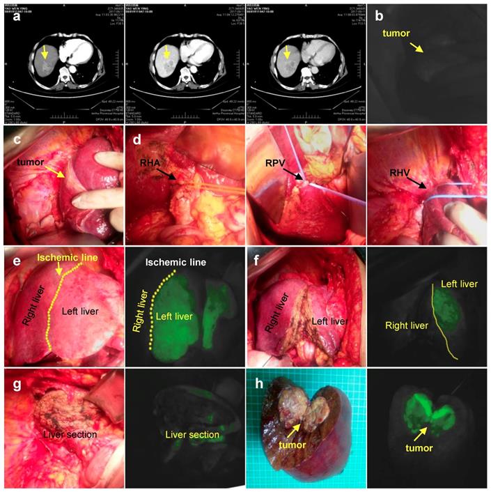 J Cancer Image