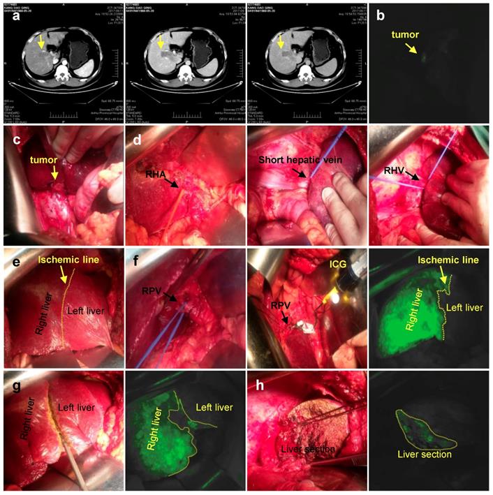 J Cancer Image