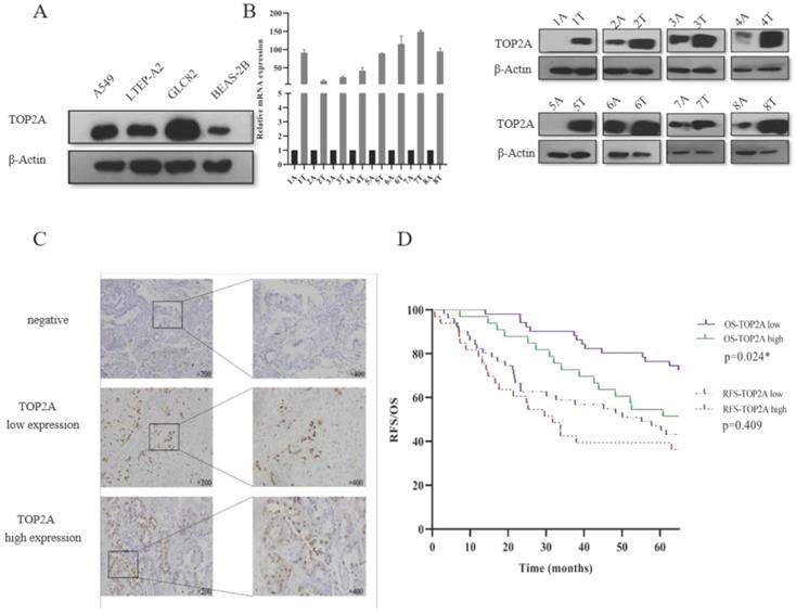 J Cancer Image