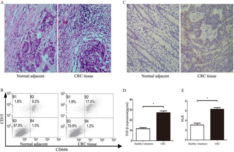 J Cancer Image