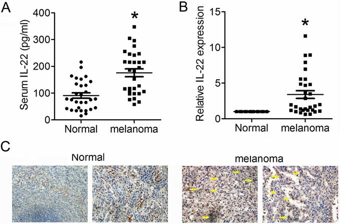 J Cancer Image