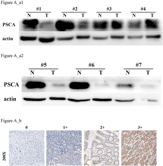 J Cancer Image