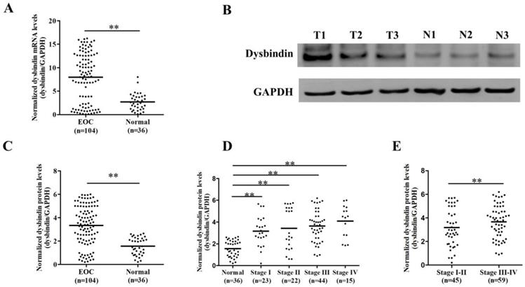 J Cancer Image