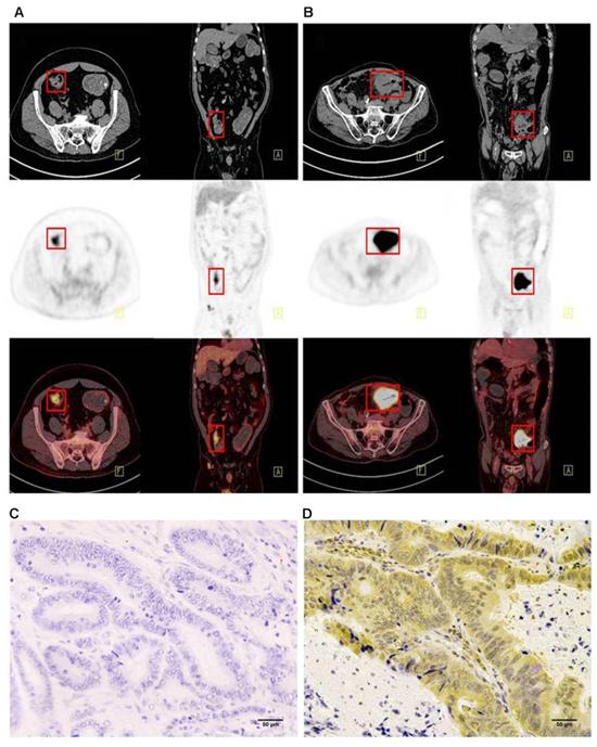 J Cancer Image