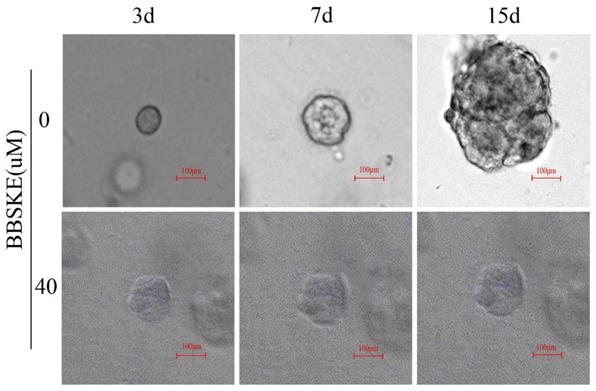 J Cancer Image