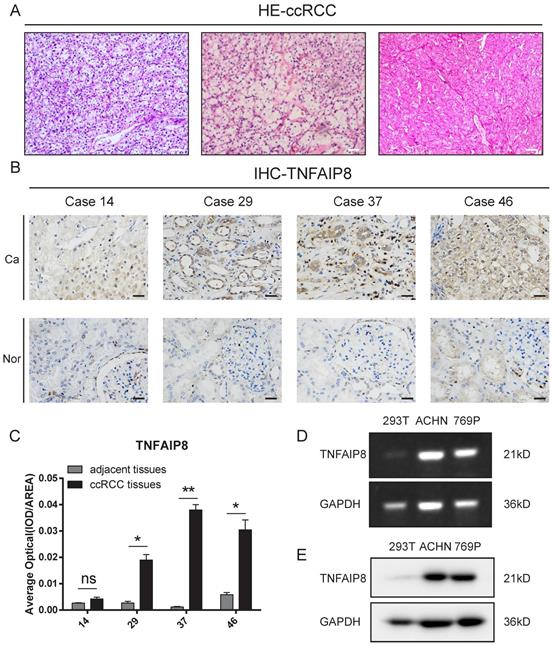 J Cancer Image