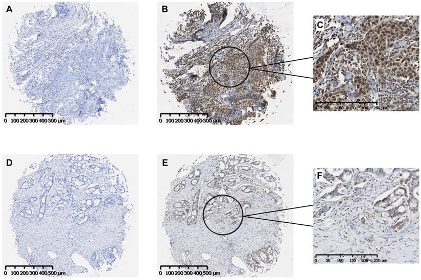 J Cancer Image