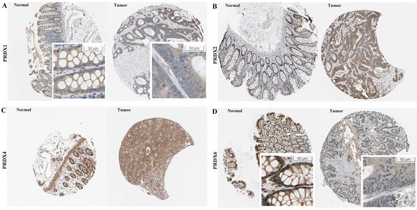 J Cancer Image