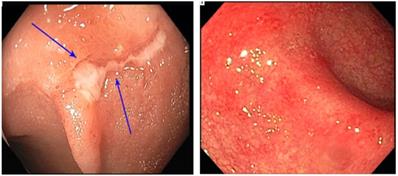 J Cancer Image