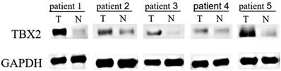 J Cancer Image