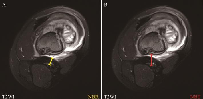 J Cancer Image