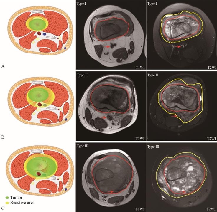 J Cancer Image