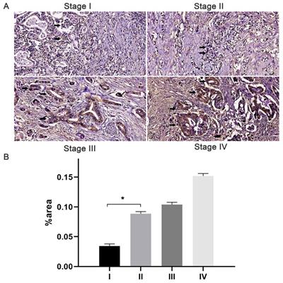 J Cancer Image