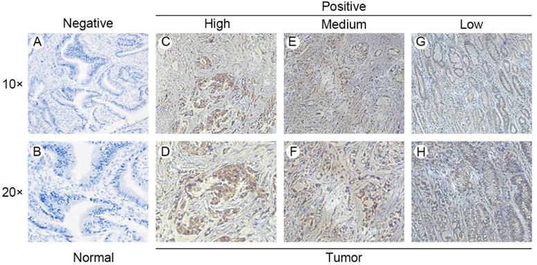 J Cancer Image