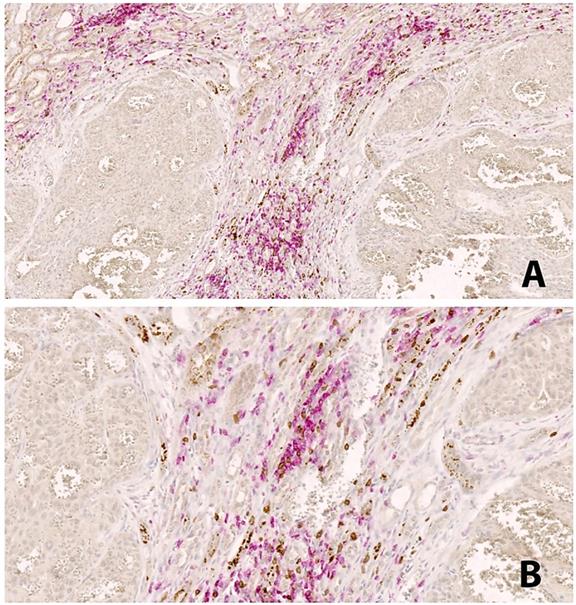 J Cancer Image