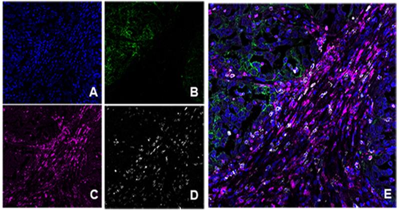 J Cancer Image