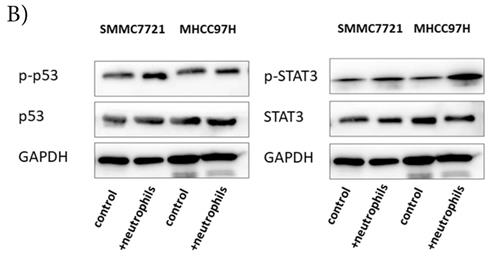 J Cancer Image