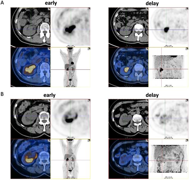 J Cancer Image