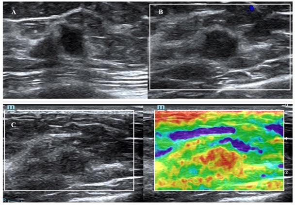 J Cancer Image