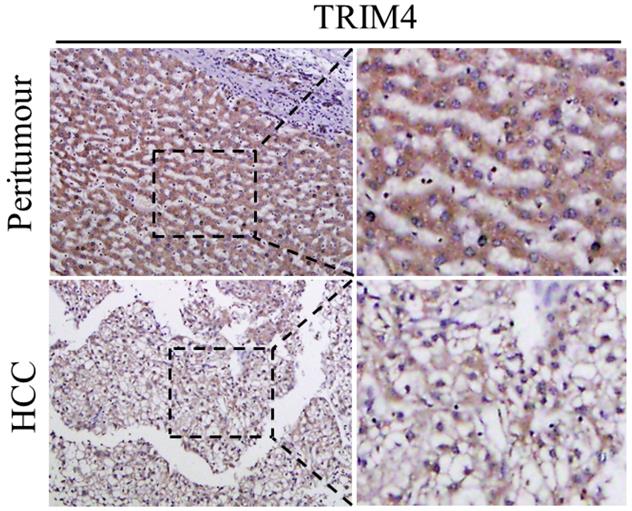 J Cancer Image