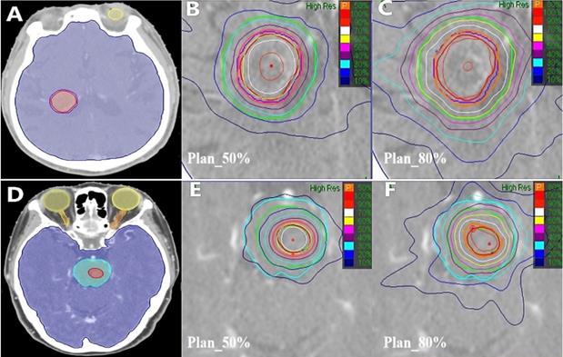 J Cancer Image