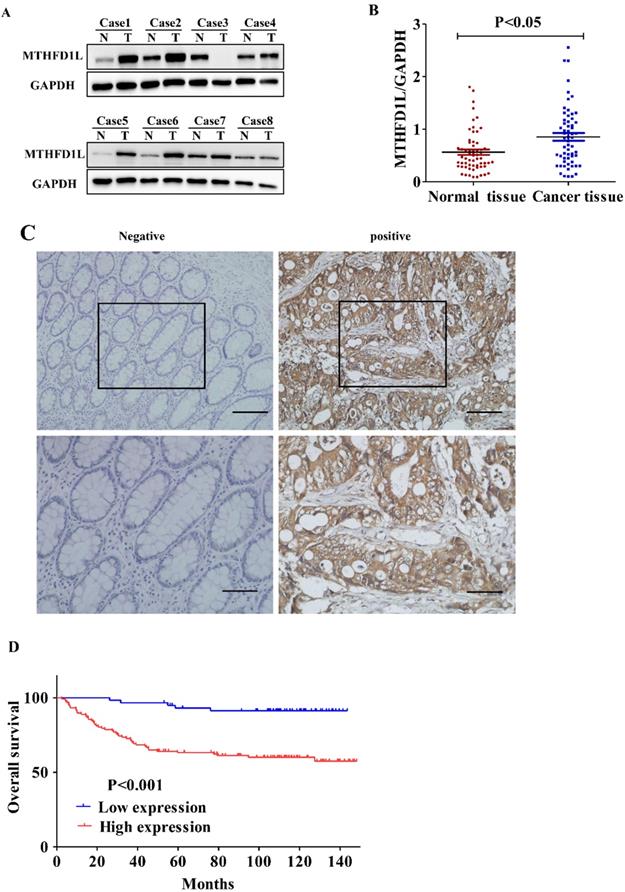 J Cancer Image