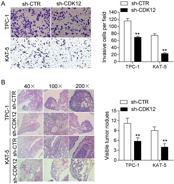 J Cancer Image