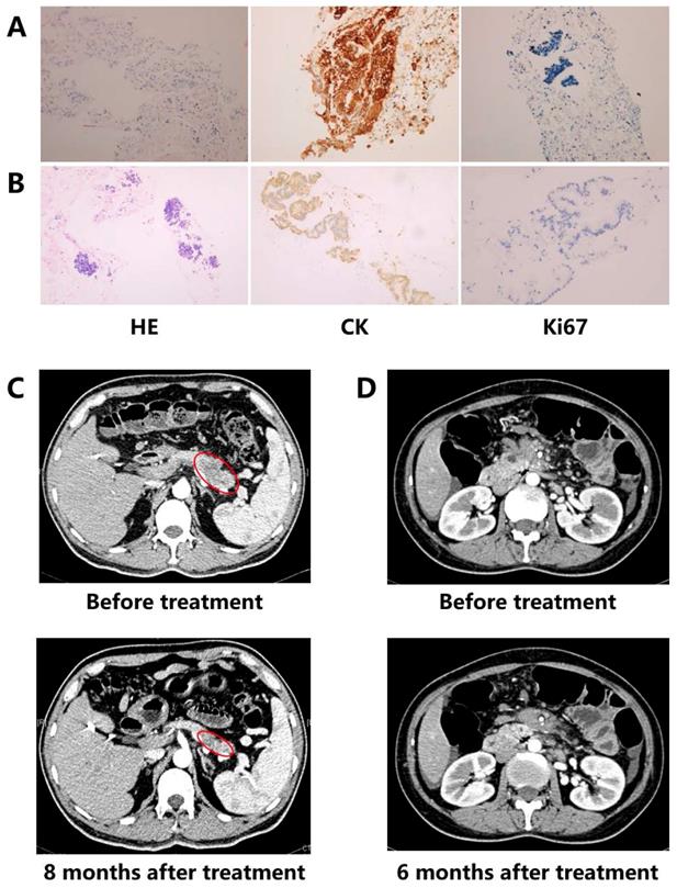 J Cancer Image