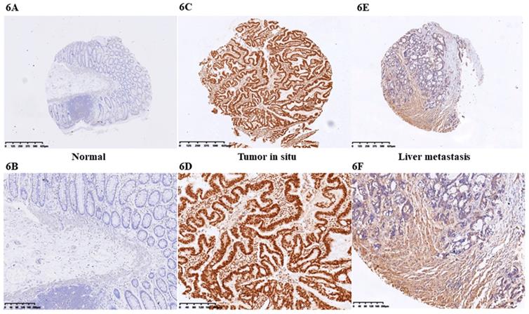 J Cancer Image