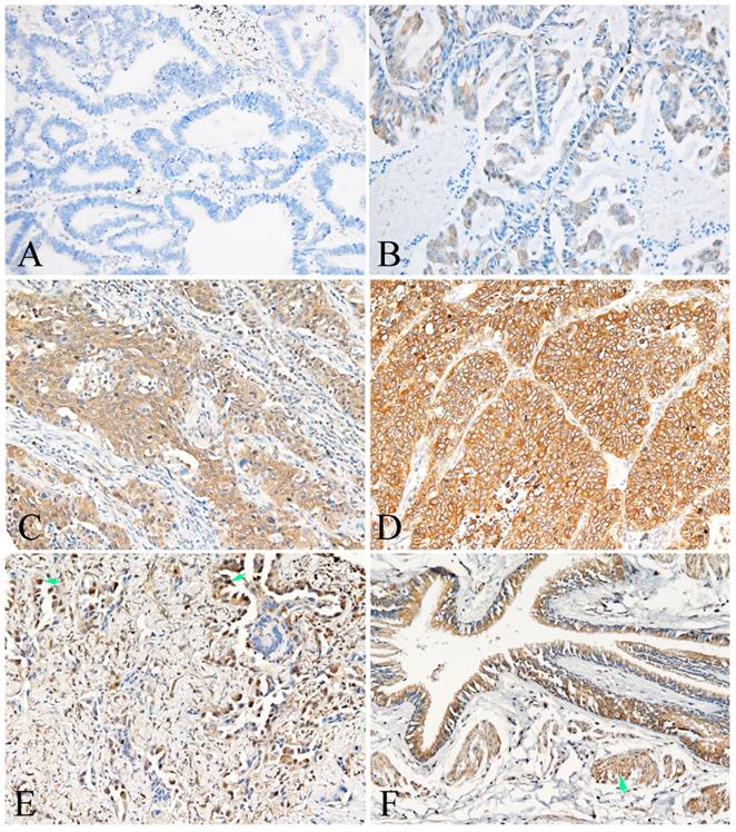 J Cancer Image