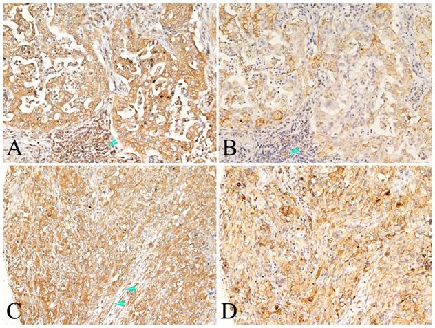 J Cancer Image