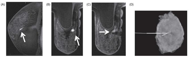 J Cancer Image