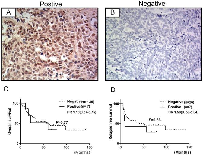 J Cancer Image