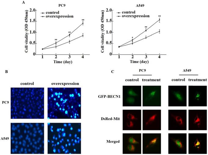 J Cancer Image