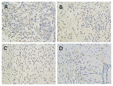 J Cancer Image