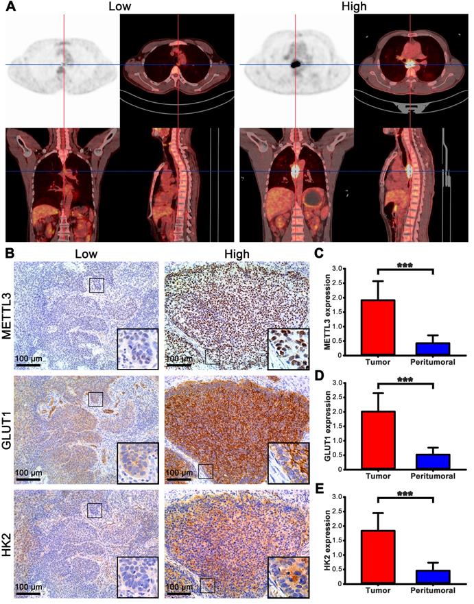 J Cancer Image