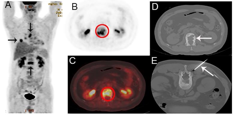 J Cancer Image