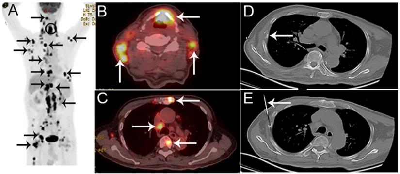 J Cancer Image