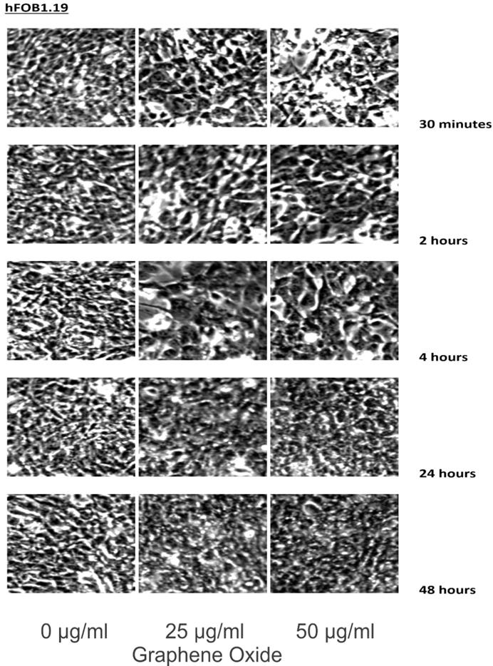 J Cancer Image