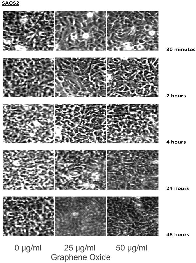 J Cancer Image