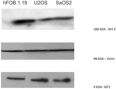 J Cancer Image