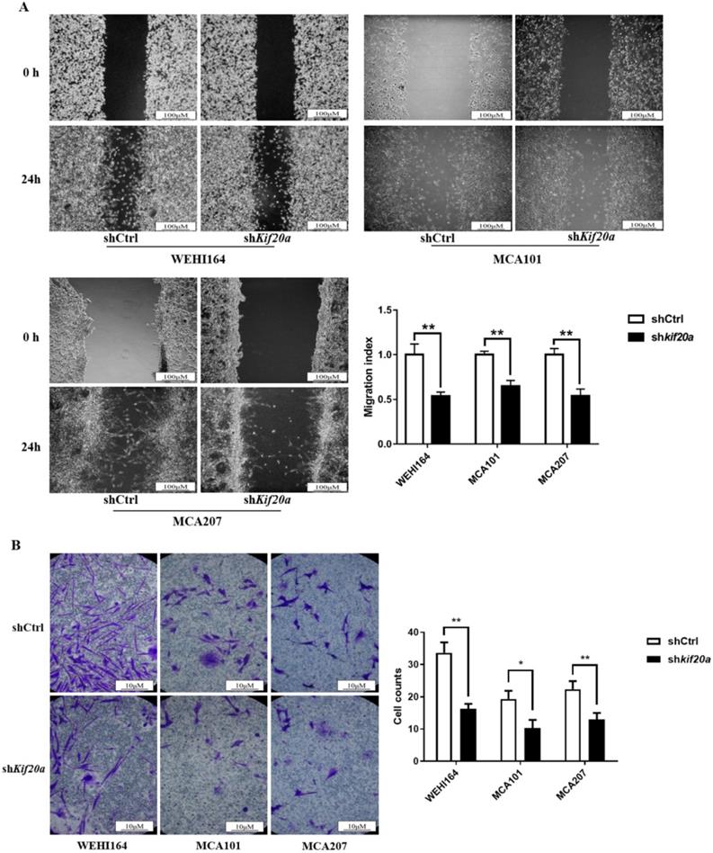 J Cancer Image