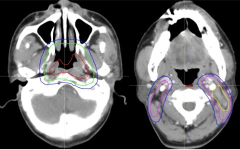 J Cancer Image