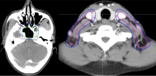 J Cancer Image