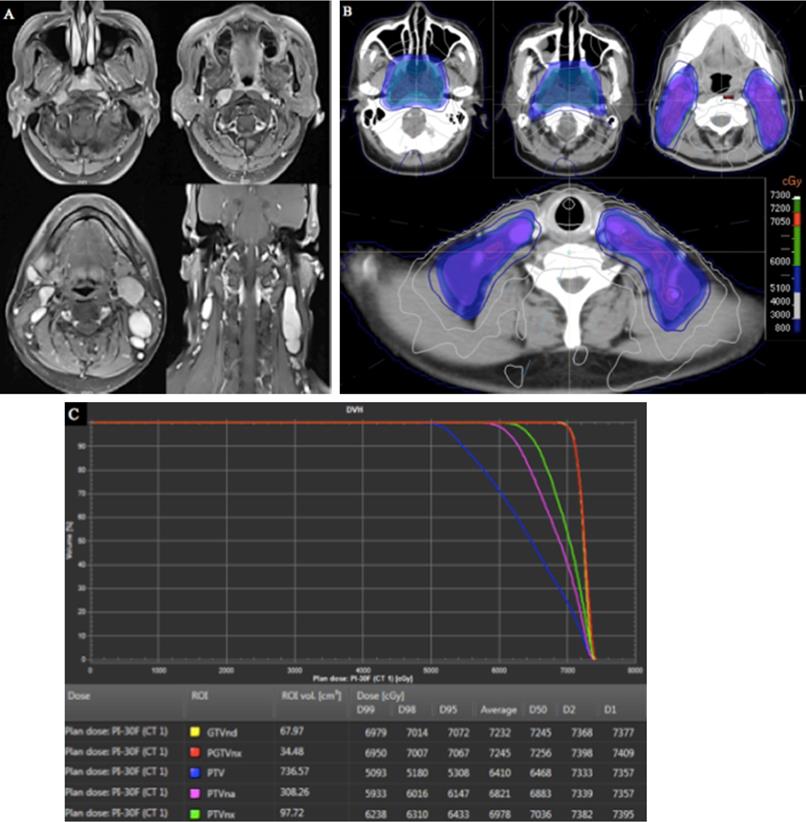 J Cancer Image